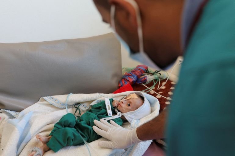 Hunger is looming over Yemen, urgent action is needed